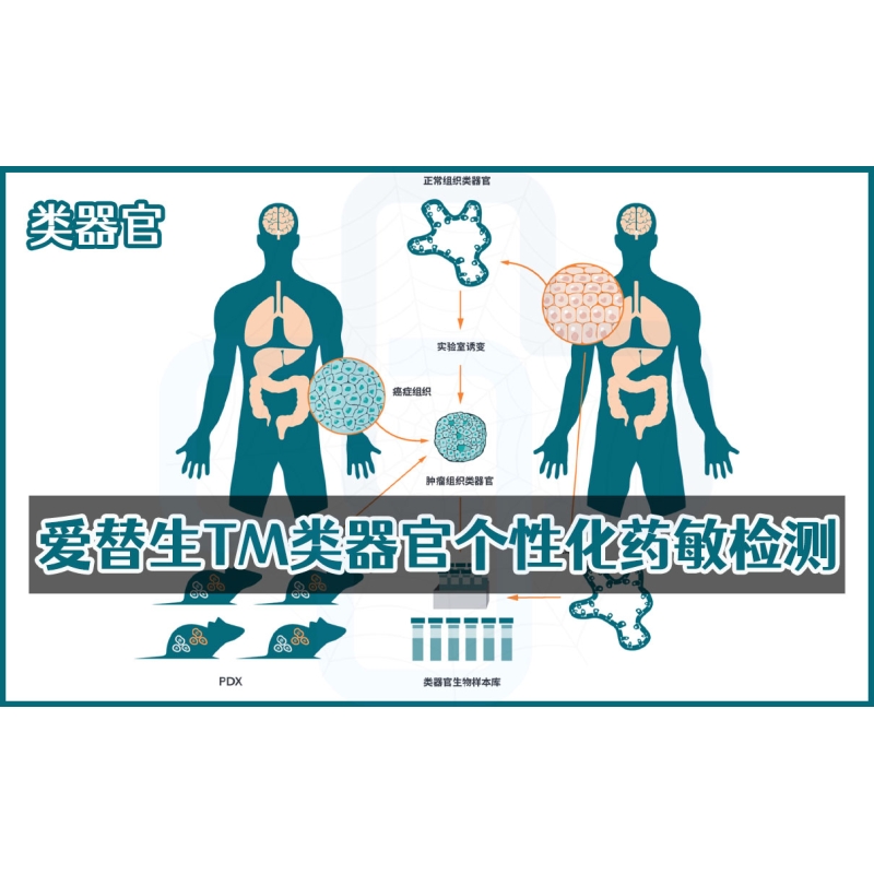 【类器官】爱替生TM类器官个性化药敏检测